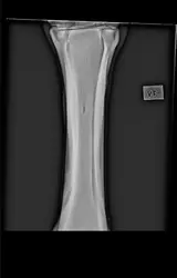 Screenshot_20250718_171333_Gallery.webp