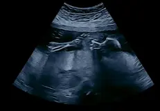 Screenshot_20260217_211002_Video Player.webp
