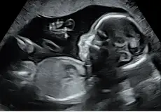 #Ultrasound_4.webp
